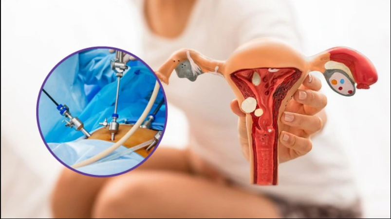 Endometriosis Treatment at Phular IVF
