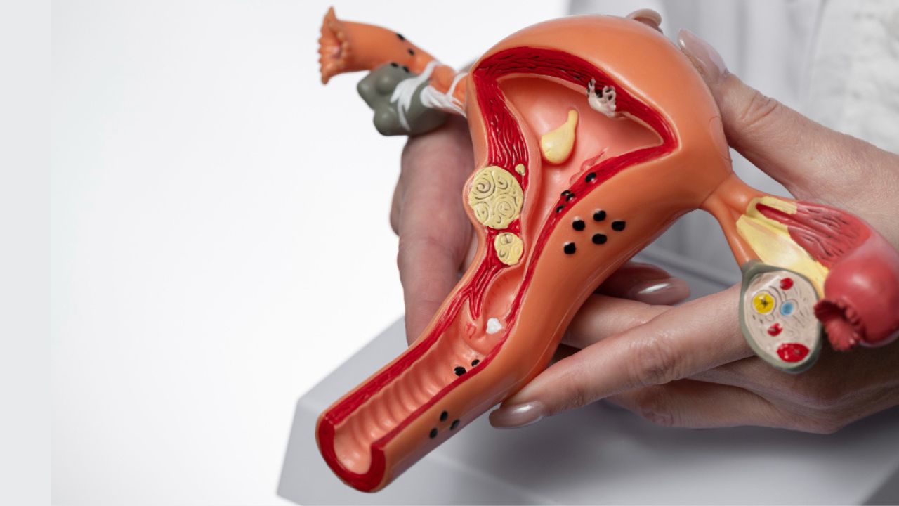 Ovarian Rejuvenation Treatment