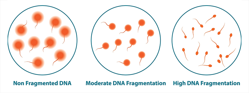 DFI DNA Fragmentation Test