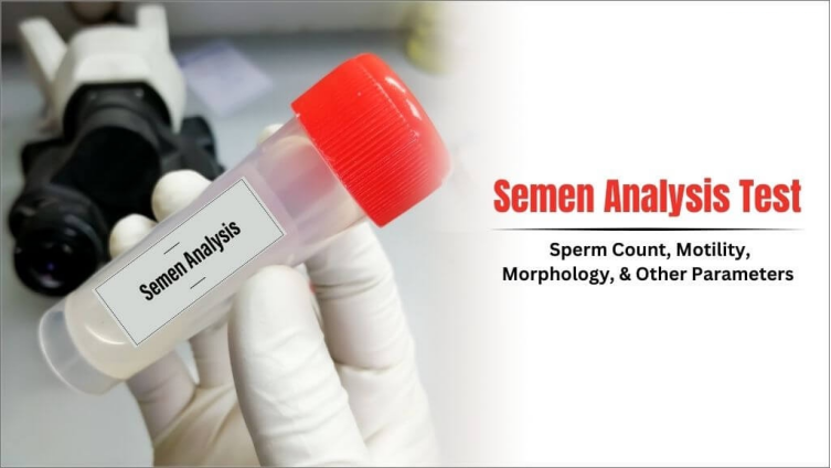 Semen Analysis