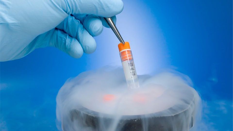 Cryopreservation